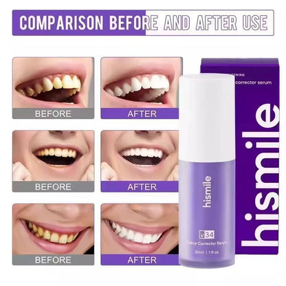 Sérum correcteur de couleur Hismile™ V34